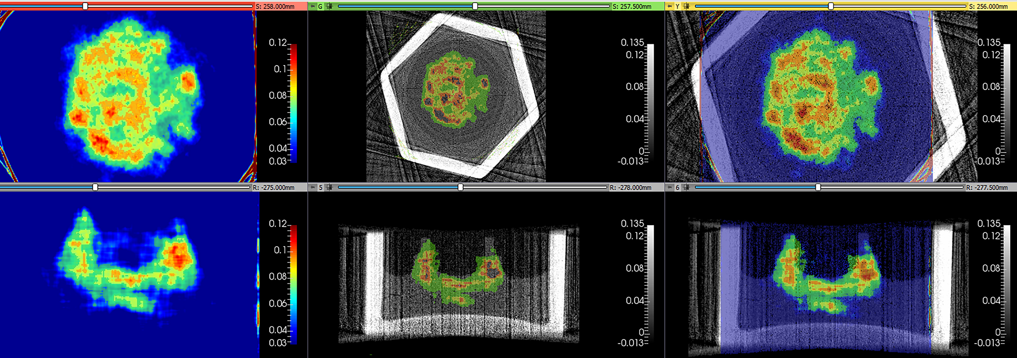 X-ray fluorescence imaging with nanoparticles